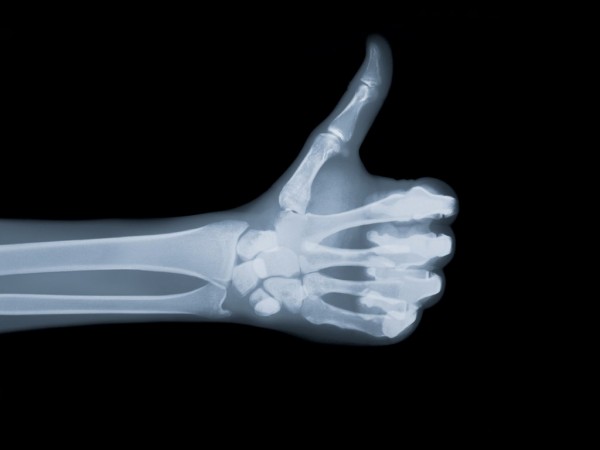 Une radiographie d'une main qui lève le pouce