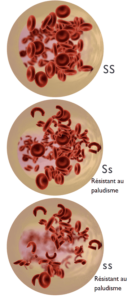 Allèle récessif, dominant, co-dominant, globules rouges