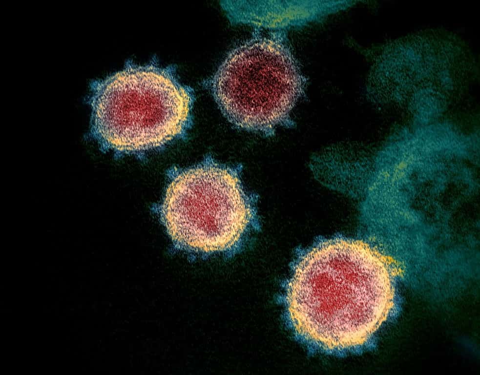Comment distinguer épidémie et pandémie ?